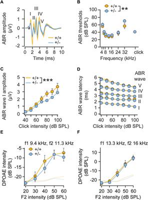 Monoallelic loss of the F-actin-binding protein radixin facilitates startle reactivity and pre-pulse inhibition in mice